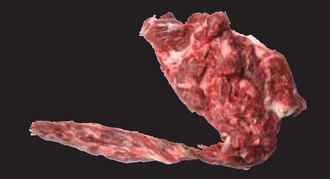 Neck